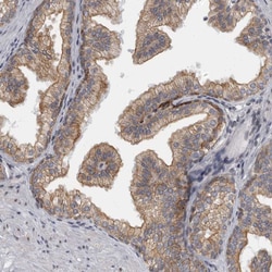Invitrogen EVI5 Polyclonal Antibody 100 &mu;L; Unconjugated:Antibodies,