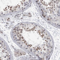 Invitrogen EVI5 Polyclonal Antibody 100 &mu;L; Unconjugated:Antibodies,