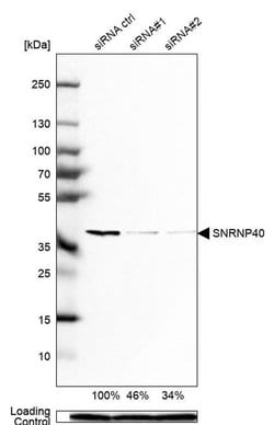 SNRNP40 Polyclonal Antibody, Invitrogen&trade; 100 &mu;L; Unconjugated 