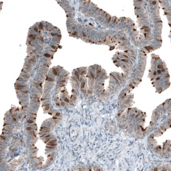 CDK20 Polyclonal Antibody:Antibodies, Polyclonal
