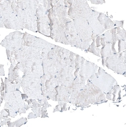 CDK20 Polyclonal Antibody:Antibodies, Polyclonal