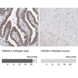 CDK20 Polyclonal Antibody:Antibodies, Polyclonal