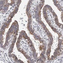 CDK20 Polyclonal Antibody:Antibodies, Polyclonal