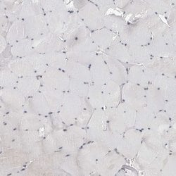 CDK20 Polyclonal Antibody:Antibodies, Polyclonal
