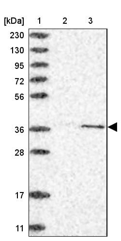 Invitrogen CDK20 Polyclonal Antibody 100 &mu;L | Buy Online | Invitrogen&trade; | Fisher Scientific