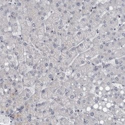Invitrogen MRCK gamma Polyclonal Antibody 100 &mu;L | Buy Online | Invitrogen&trade; | Fisher Scientific