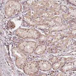 MMACHC Polyclonal Antibody:Antibodies, Polyclonal