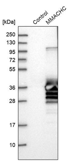 MMACHC Polyclonal Antibody:Antibodies, Polyclonal