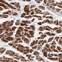Invitrogen CDK20 Polyclonal Antibody 100 &mu;L; Unconjugated:Antibodies,