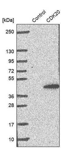 Invitrogen CDK20 Polyclonal Antibody 100 &mu;L; Unconjugated:Antibodies,