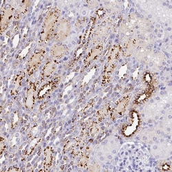 Invitrogen MMACHC Polyclonal Antibody 100 &mu;L; Unconjugated:Antibodies,