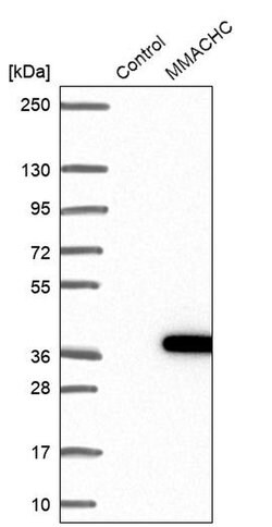 Invitrogen MMACHC Polyclonal Antibody 100 &mu;L; Unconjugated:Antibodies,