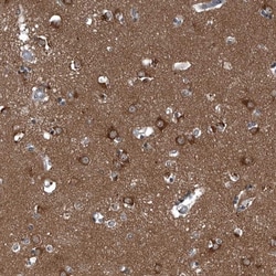 GAK Polyclonal Antibody:Antibodies, Polyclonal