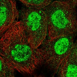 Invitrogen TRIM66 Polyclonal Antibody 100 &mu;L; Unconjugated:Antibodies,