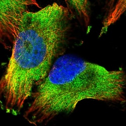 PUM1 Polyclonal Antibody:Antibodies, Polyclonal