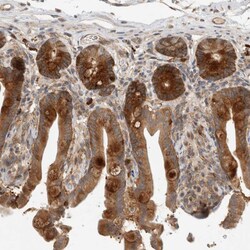 PUM1 Polyclonal Antibody:Antibodies, Polyclonal