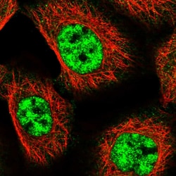 MED18 Polyclonal Antibody:Antibodies, Polyclonal