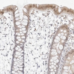 MED18 Polyclonal Antibody:Antibodies, Polyclonal