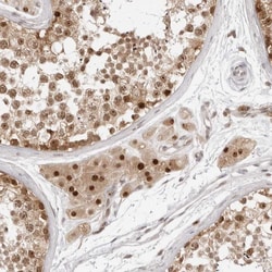Invitrogen C8orf48 Polyclonal Antibody 100 &mu;L | Buy Online | Invitrogen&trade; | Fisher Scientific