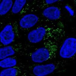 Invitrogen HMGCS2 Polyclonal Antibody 100 &mu;L; Unconjugated:Antibodies,