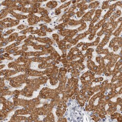Invitrogen HMGCS2 Polyclonal Antibody 100 &mu;L; Unconjugated:Antibodies,
