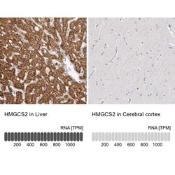 Invitrogen HMGCS2 Polyclonal Antibody 100 &mu;L; Unconjugated:Antibodies,