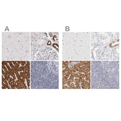 Invitrogen HMGCS2 Polyclonal Antibody 100 &mu;L; Unconjugated:Antibodies,