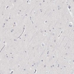 Invitrogen HMGCS2 Polyclonal Antibody 100 &mu;L; Unconjugated:Antibodies,