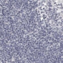Invitrogen HMGCS2 Polyclonal Antibody 100 &mu;L; Unconjugated:Antibodies,