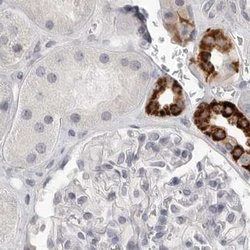 Invitrogen HMGCS2 Polyclonal Antibody 100 &mu;L; Unconjugated:Antibodies,