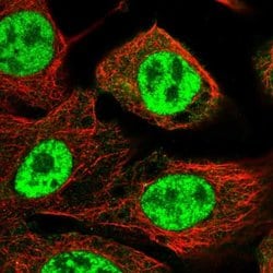 Invitrogen PPP1R8 Polyclonal Antibody 100 &mu;L; Unconjugated:Antibodies,