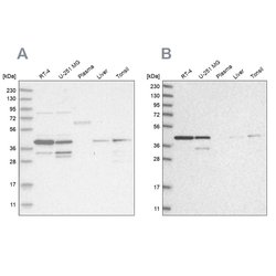 Invitrogen PPP1R8 Polyclonal Antibody 100 &mu;L; Unconjugated:Antibodies,