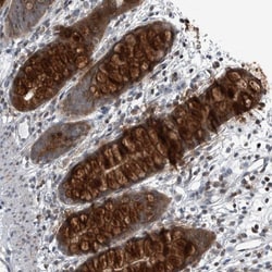 GAK Polyclonal Antibody:Antibodies, Polyclonal