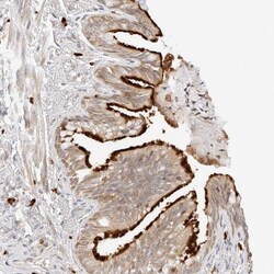 Invitrogen TEKT2 Polyclonal Antibody 100 &mu;L; Unconjugated:Antibodies,