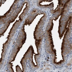 Invitrogen GAK Polyclonal Antibody 100 &mu;L | Buy Online | Invitrogen&trade; | Fisher Scientific