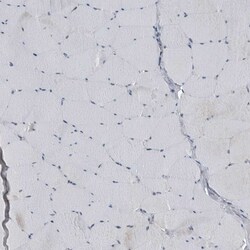 Invitrogen GAK Polyclonal Antibody 100 &mu;L | Buy Online | Invitrogen&trade; | Fisher Scientific