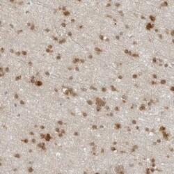 Invitrogen CC2D1B Polyclonal Antibody 100 &mu;L; Unconjugated:Antibodies,