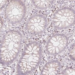 GNMT Polyclonal Antibody:Antibodies, Polyclonal