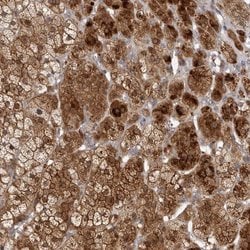 Invitrogen TBC1D8B Polyclonal Antibody 100 &mu;L; Unconjugated:Antibodies,