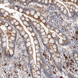 Invitrogen ATXN3L Polyclonal Antibody 100 &mu;L; Unconjugated:Antibodies,