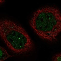 Invitrogen TC2N Polyclonal Antibody 100 &mu;L; Unconjugated:Antibodies,
