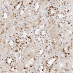 Invitrogen RCC1 Polyclonal Antibody 100 &mu;L | Buy Online | Invitrogen&trade; | Fisher Scientific