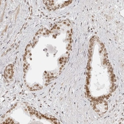 Invitrogen RCC1 Polyclonal Antibody 100 &mu;L | Buy Online | Invitrogen&trade; | Fisher Scientific