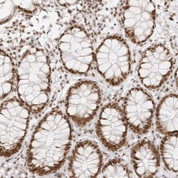 Invitrogen RCC1 Polyclonal Antibody 100 &mu;L | Buy Online | Invitrogen&trade; | Fisher Scientific