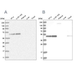 Invitrogen RCC1 Polyclonal Antibody 100 &mu;L | Buy Online | Invitrogen&trade; | Fisher Scientific