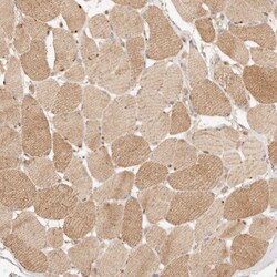 Invitrogen PHLDA3 Polyclonal Antibody 100 &mu;L; Unconjugated:Antibodies,