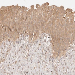 Invitrogen PHLDA3 Polyclonal Antibody 100 &mu;L; Unconjugated:Antibodies,