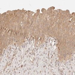 Invitrogen PHLDA3 Polyclonal Antibody 100 &mu;L; Unconjugated:Antibodies,