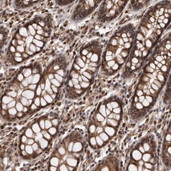 Invitrogen ADAMTS20 Polyclonal Antibody 100 &mu;L; Unconjugated:Antibodies,