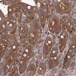 Invitrogen ADAMTS20 Polyclonal Antibody 100 &mu;L; Unconjugated:Antibodies,